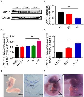 The Role of Sorting Nexin 17 in Cardiac Development